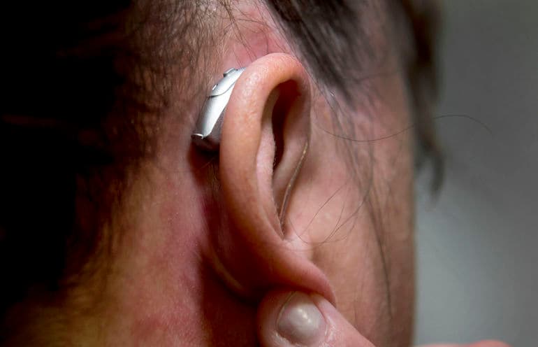 Søren E. Alwan/Jysk Fynske Medier/Ritzau Scanpix